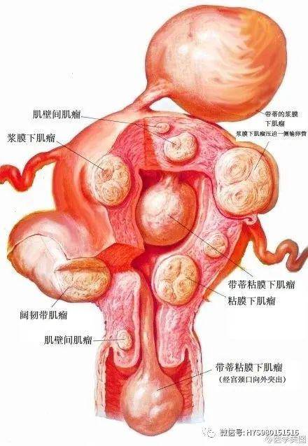 45,子宫肌瘤44,孕期阑尾位置变化43,孕期改变42,月经周期42,异位妊娠