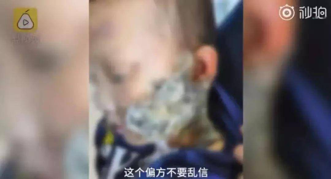 孩子|不及格的父母对孩子的伤害太大了这2个育儿误区害了无数宝宝