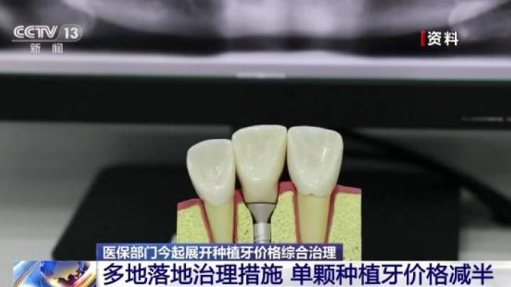 今起执行种植牙价格,你觉得合理吗?