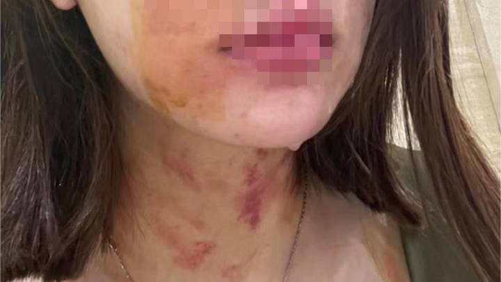 女子牵狗进电梯遭一对夫妇扯衣致胸部裸露,你怎么看?