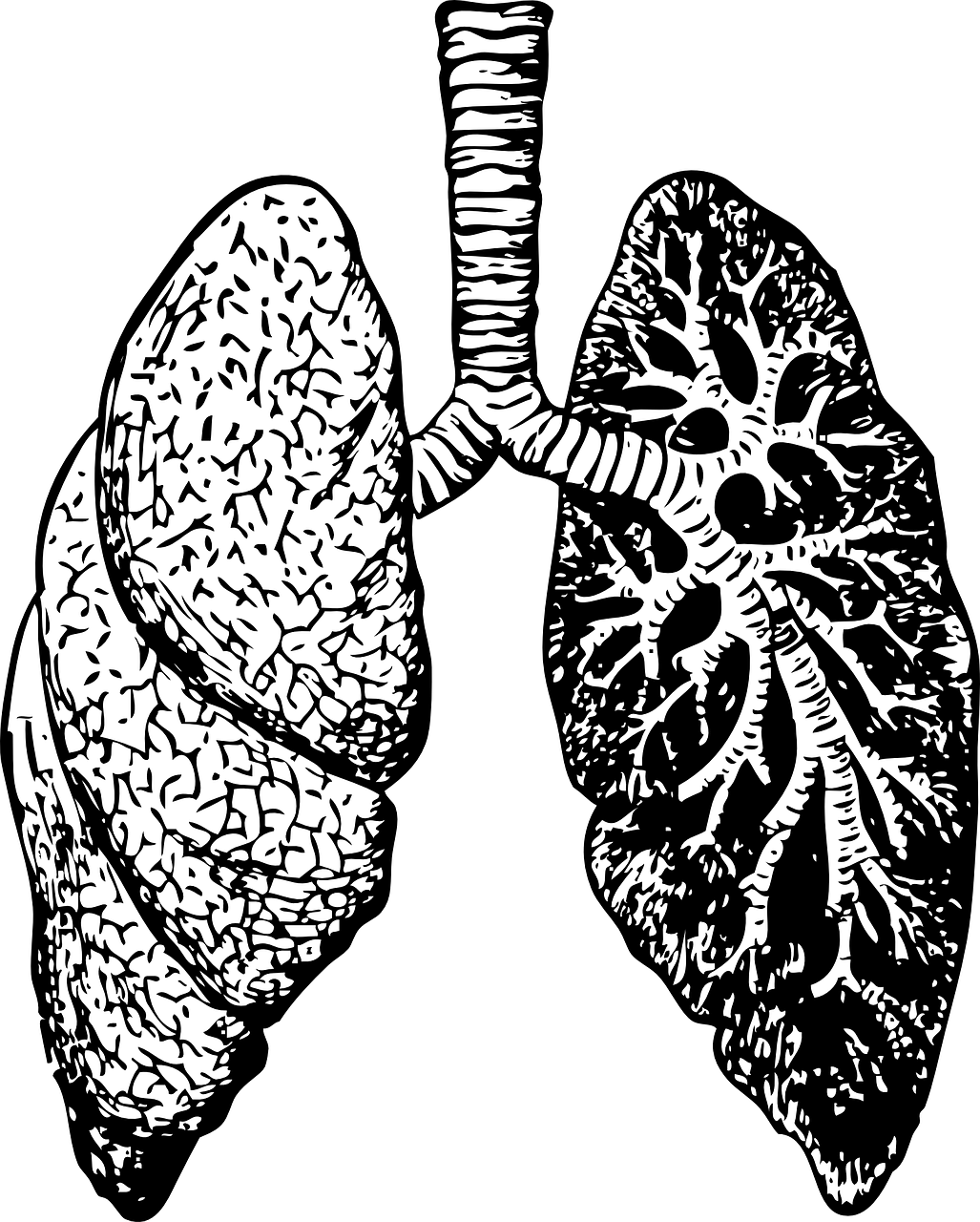 之前的文章,我们已经介绍过肺纤维患者经常会有哪些症状与体征了