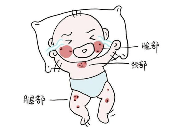宝宝牛奶过敏怎么办?恬橙益生菌来帮您