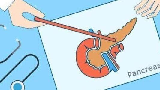 关于胰腺癌诊疗,很多医院可能在普外,肿瘤科设有门诊,由于胰腺癌诊断