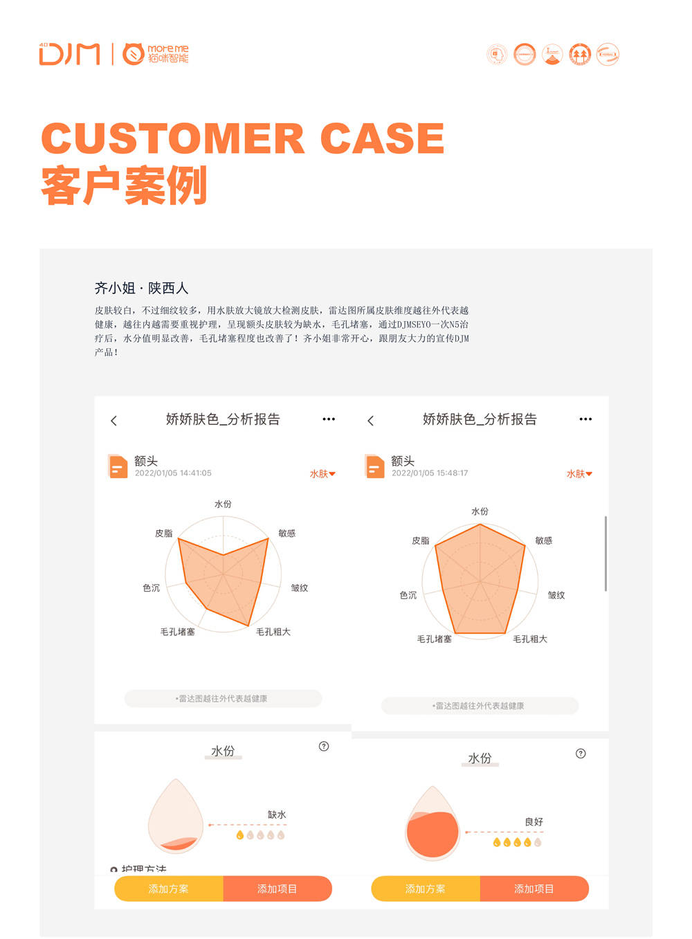 水光仪器哪个牌子好用