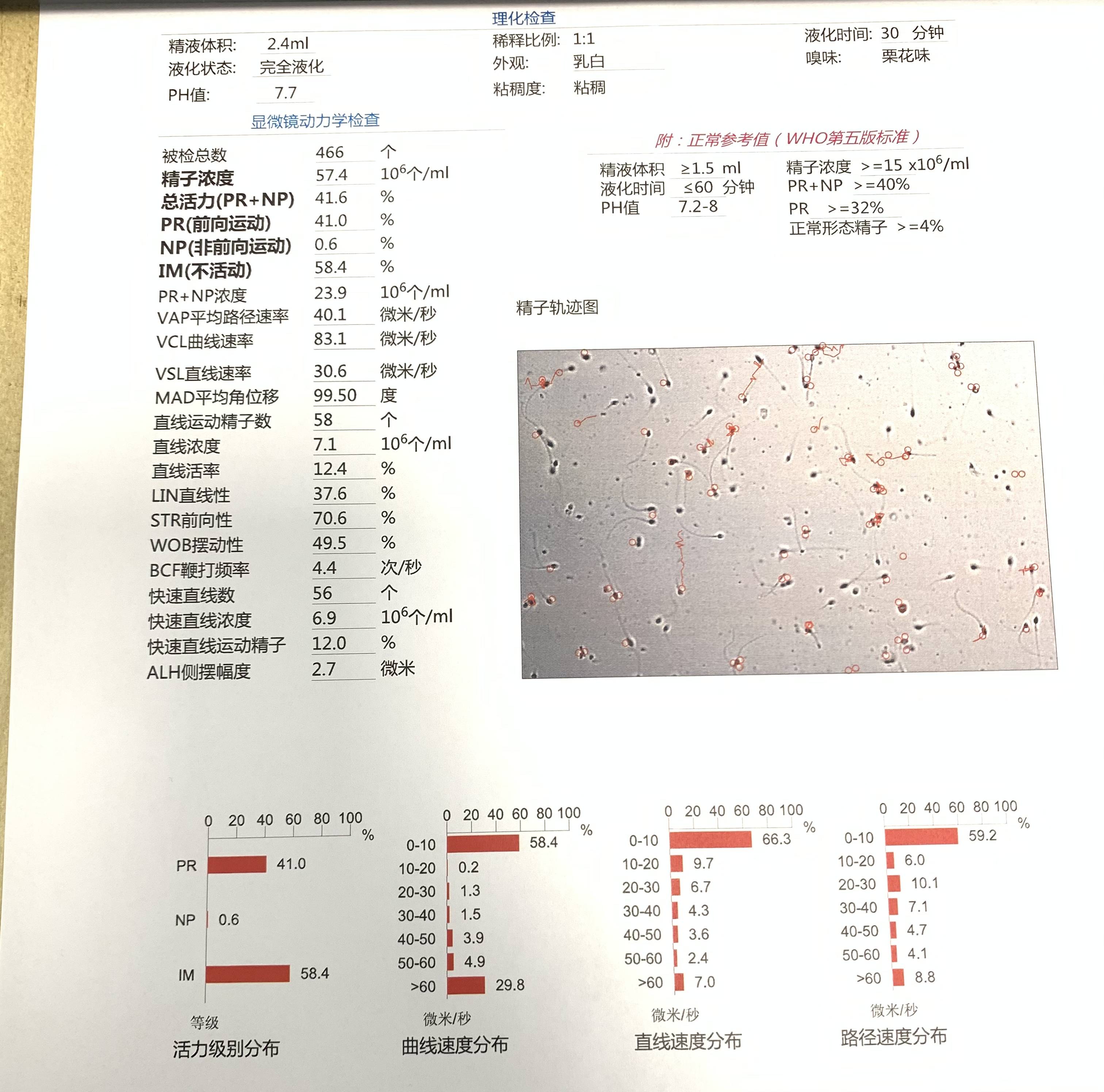 精子异常的几种情况及检查注意事项，很多男性不知道