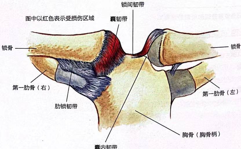 深圳体能培训：胸锁关节扭伤