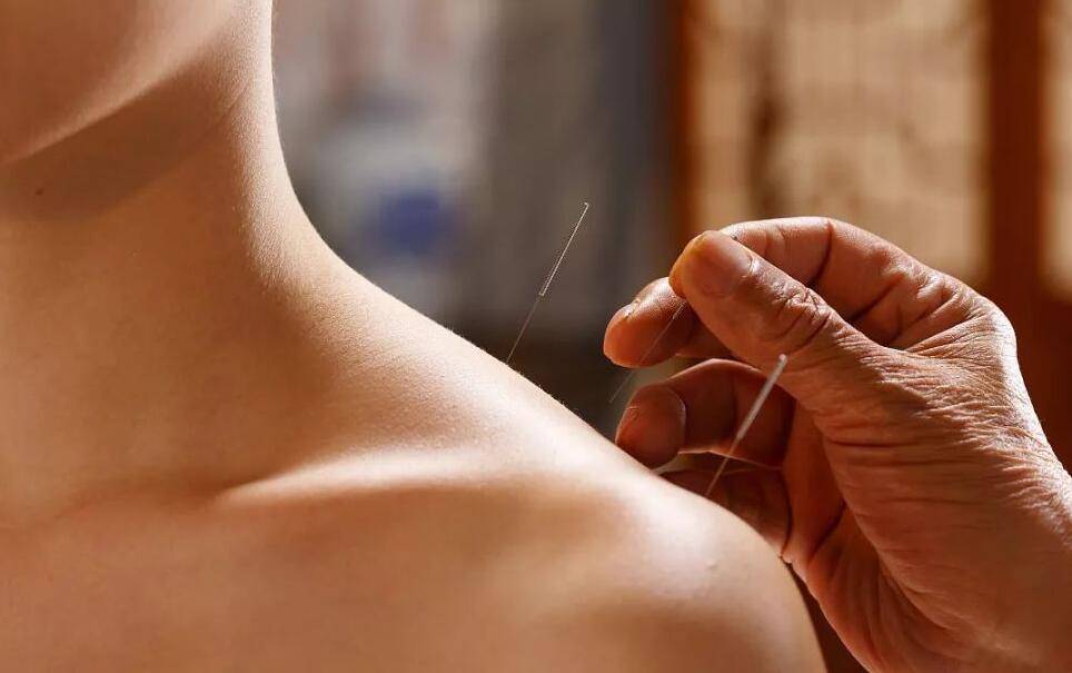 针灸中医如何调理月经不调？1、口服药物：当患者出现月经不调的情况时，