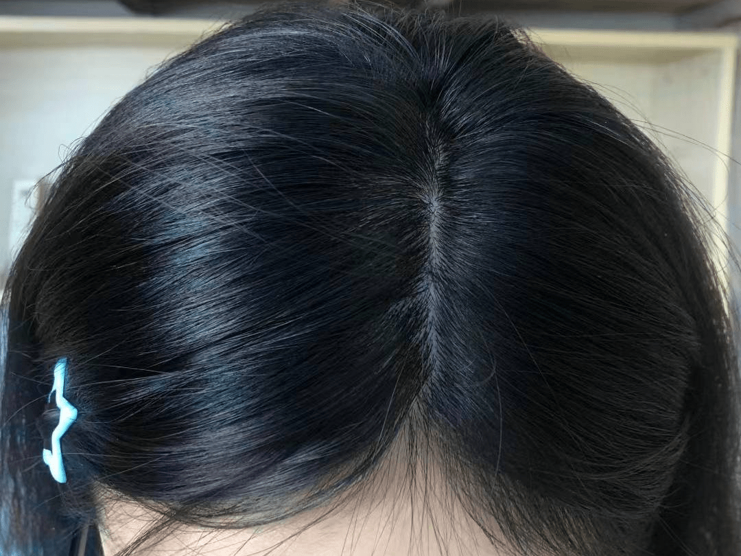头发又细又软还总掉？用这三招快速养回来！新发重现坚韧浓密！