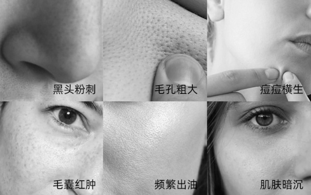 d7218cd952fe420cb6f13a45626a5ee5.png