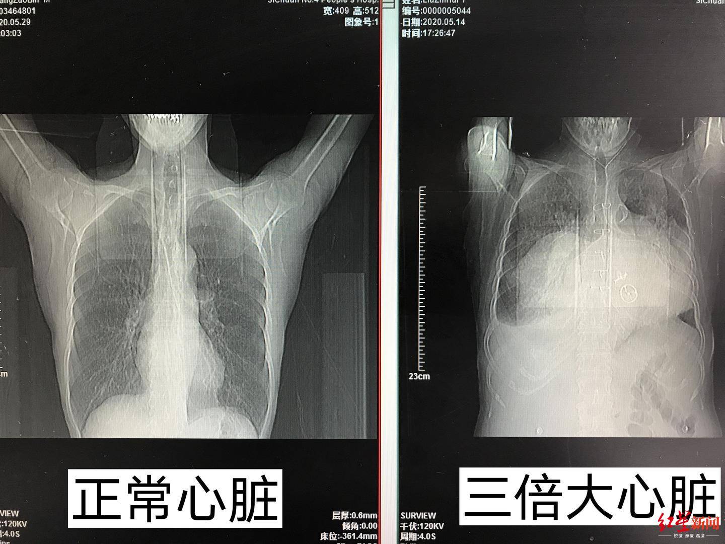 7a31972fdfe646b3a067ac5d30536971.jpeg