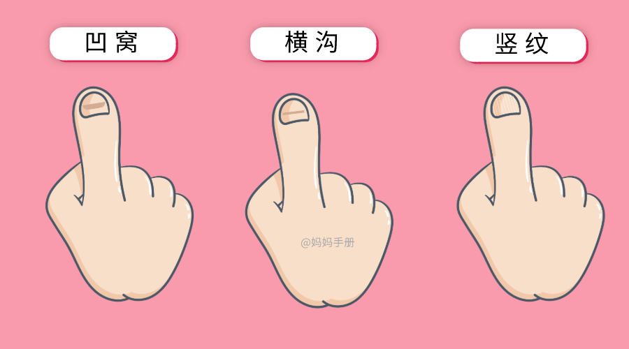 孩子|看指甲就知道！孩子身体好不好
