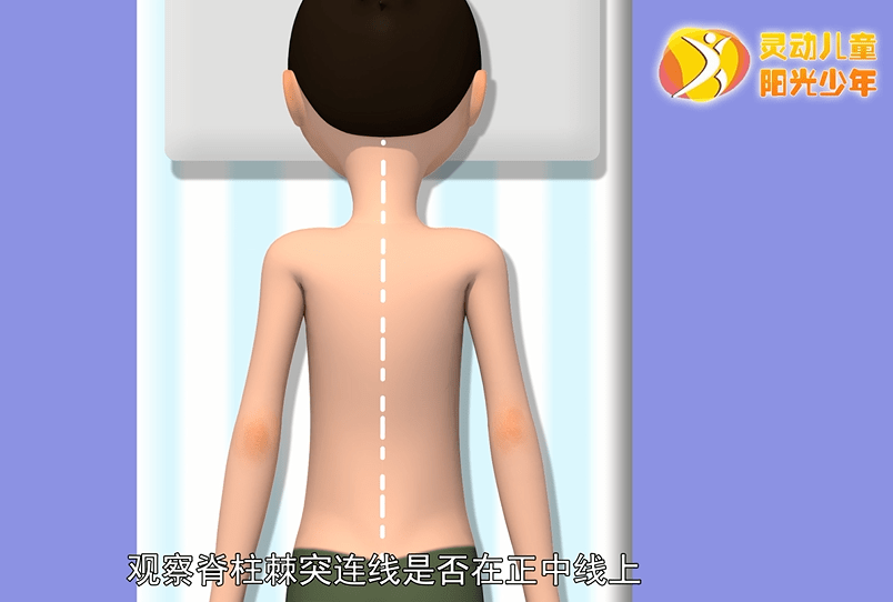 家长们注意了:孩子高低肩,坐姿不正?应警惕这病!这里有份防治指南