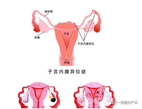 db15c423249947e3985f1bee39ae5390.png