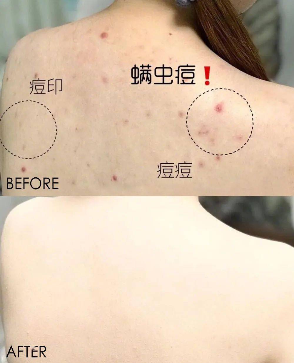 床上螨虫怎么除最方便 5375b0e32b514be39742981fbf7d800b.jpeg