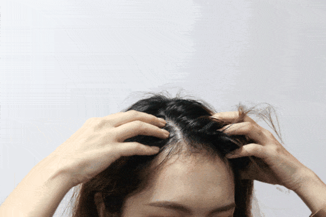 李佳琦推荐的脱发克星!一次就能拯救头屑头痒头油,用了它头发都会跳舞!