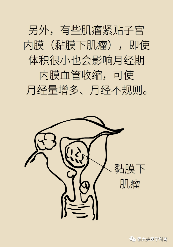 得了子宫肌瘤一定要治吗?