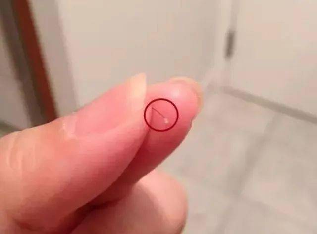 李佳琦推荐的脱发克星!一次就能拯救头屑头痒头油,用了它头发都会跳舞!