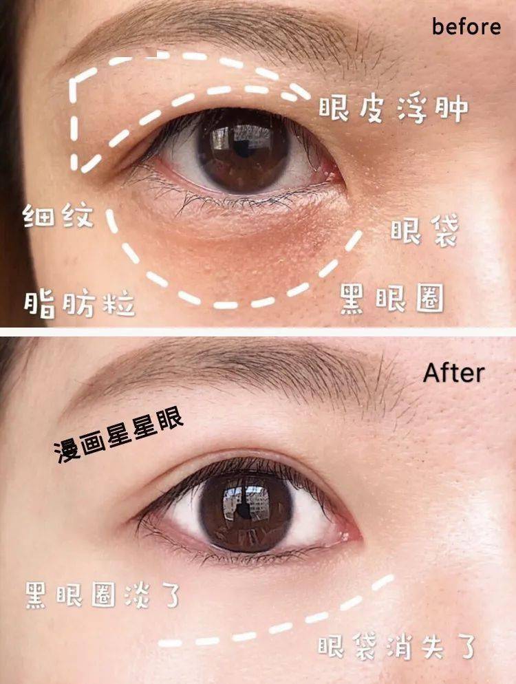 一片=10贴眼膜！解救“疲劳眼”！25分钟蒸走干黑眼圈，还你少女明眸
