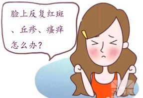 玫瑰痤疮反复发作怎么办