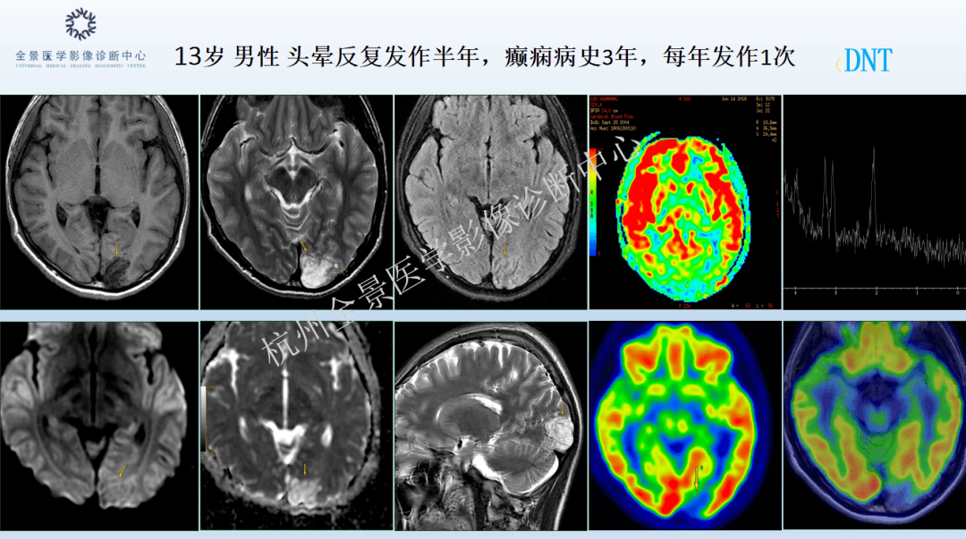 b605098569244b769a71cb8b63cf46ec.png