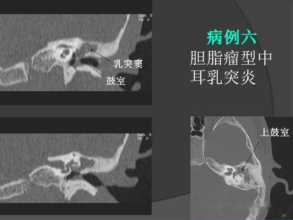 什么是三维ct重建 7ee1c312177b464db16a4745daa31235.jpeg
