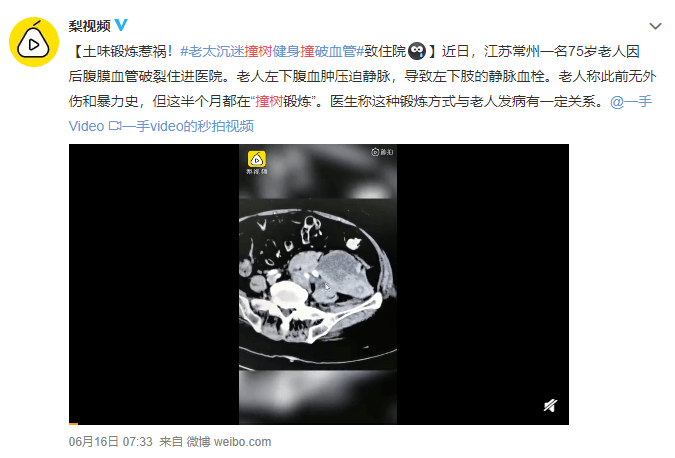 前有撞树引发血栓,现有泡澡泡出心绞痛,“土味养生”要注意啦! 前有撞树引发血栓,现有泡澡泡出心绞痛,“土味养生”要注意啦!