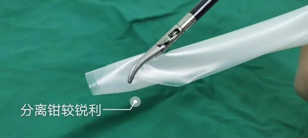 腹腔镜胆囊中那些你可能没注意到的技巧
