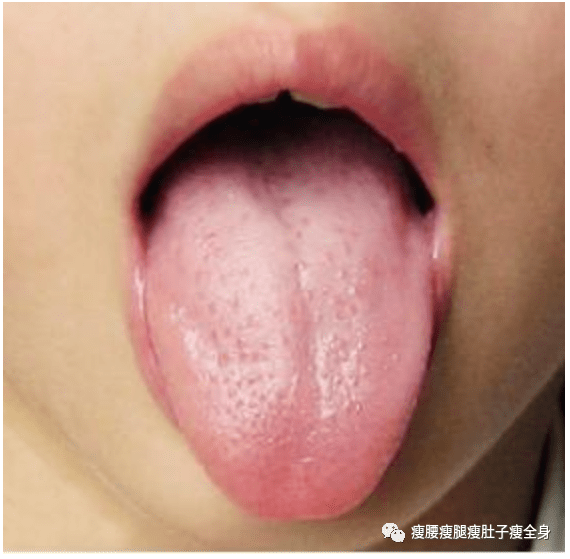 痰会人口