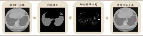 中金：把握醫藥產業終端場景變革 數字化 科技賦能的投資機會 科技 第12張