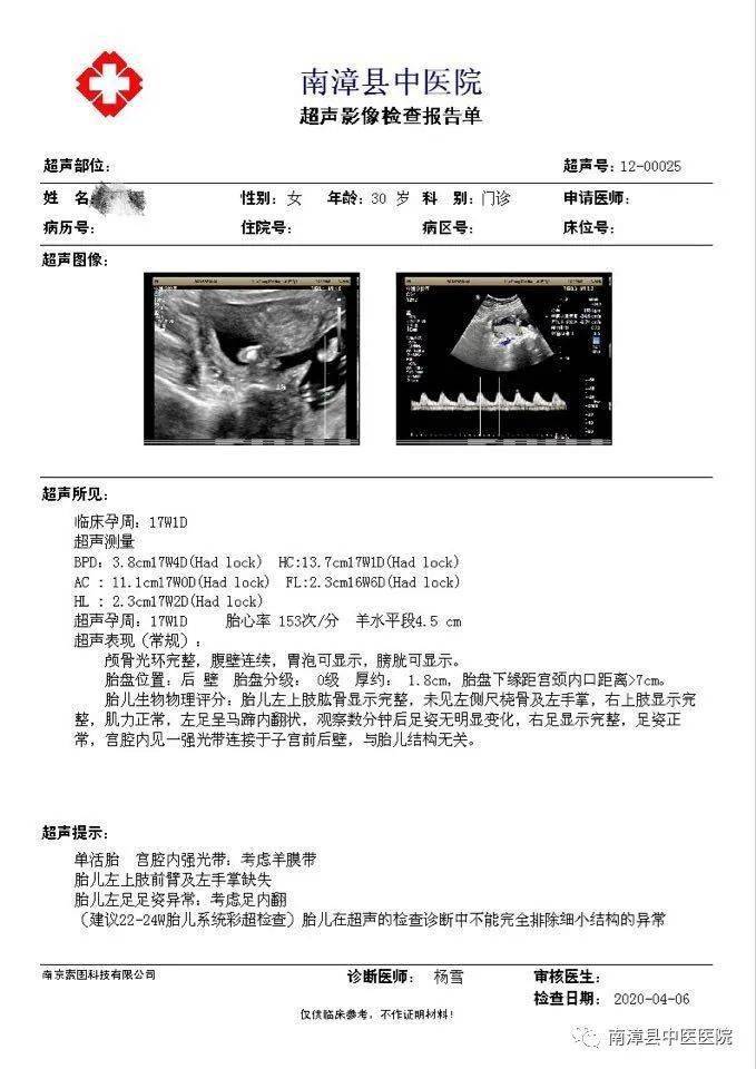 超声检查筛查胎儿畸形那些事儿