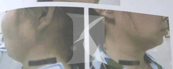 母亲|却在气急之下想勒死母亲!咋回事?上海 | 他将母亲接到身边