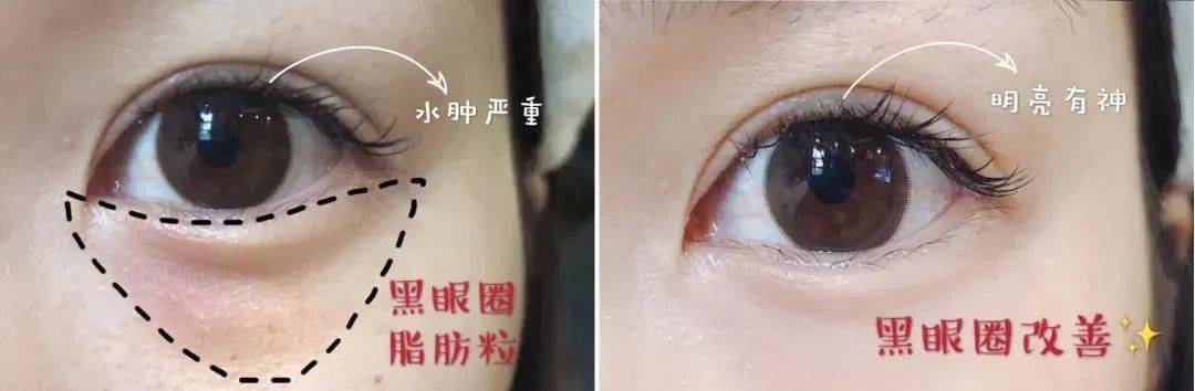 眼罩|明亮双眸!新一代冰感眼罩,冰热双温SPA,赶走黑眼圈、红血丝!