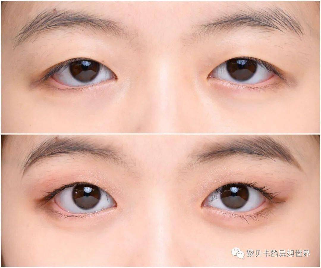 眼睛|张雨绮为啥越看越可爱，这一点真的很重要