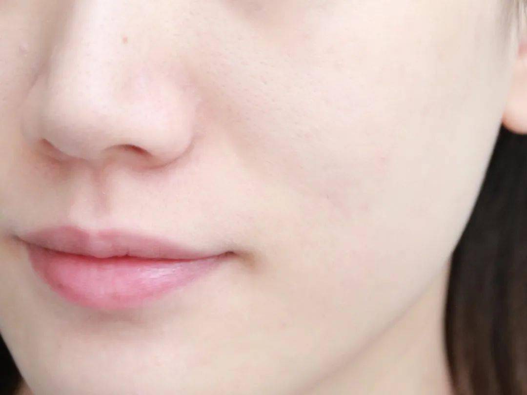 面膜|少女肌？治愈力？女团C位凭什么