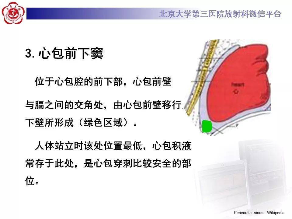 影像精美解剖丨心包窦及心包隐窝解剖建议收藏