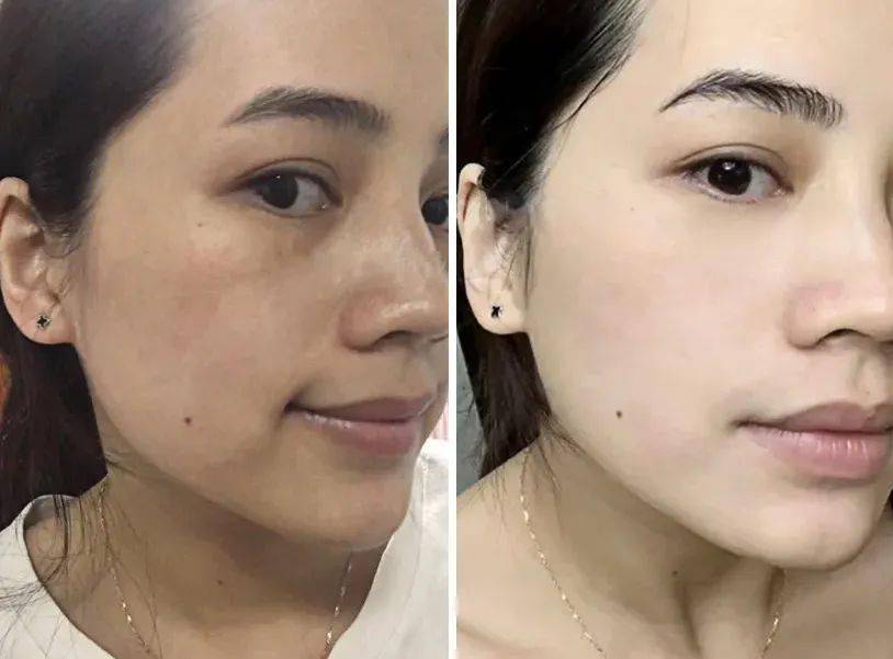 精华|千元大牌79元起！口碑水乳、眼霜精华，人气洁面应有尽有