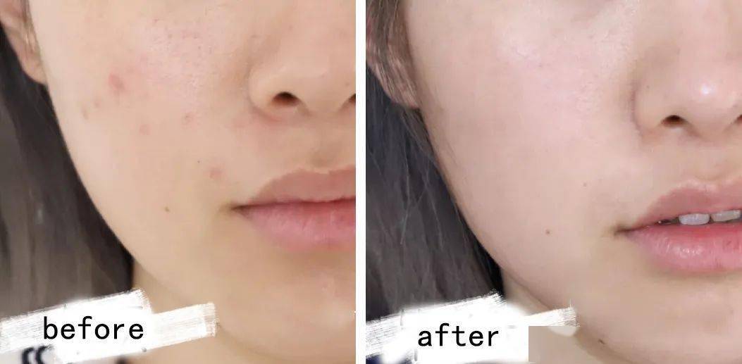 精华|千元大牌79元起！口碑水乳、眼霜精华，人气洁面应有尽有