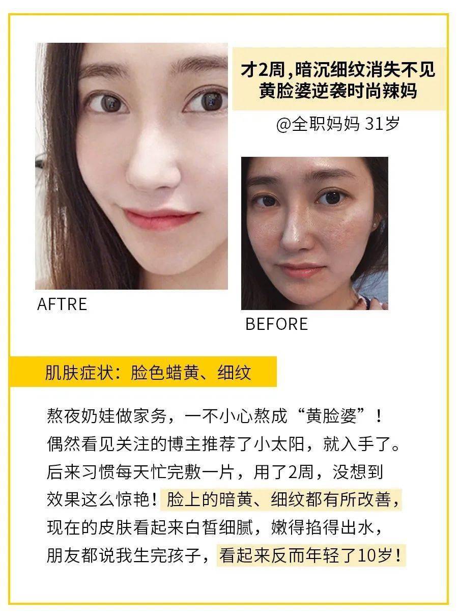 肌肤|40岁的逆袭 聪明的女人保鲜用这招