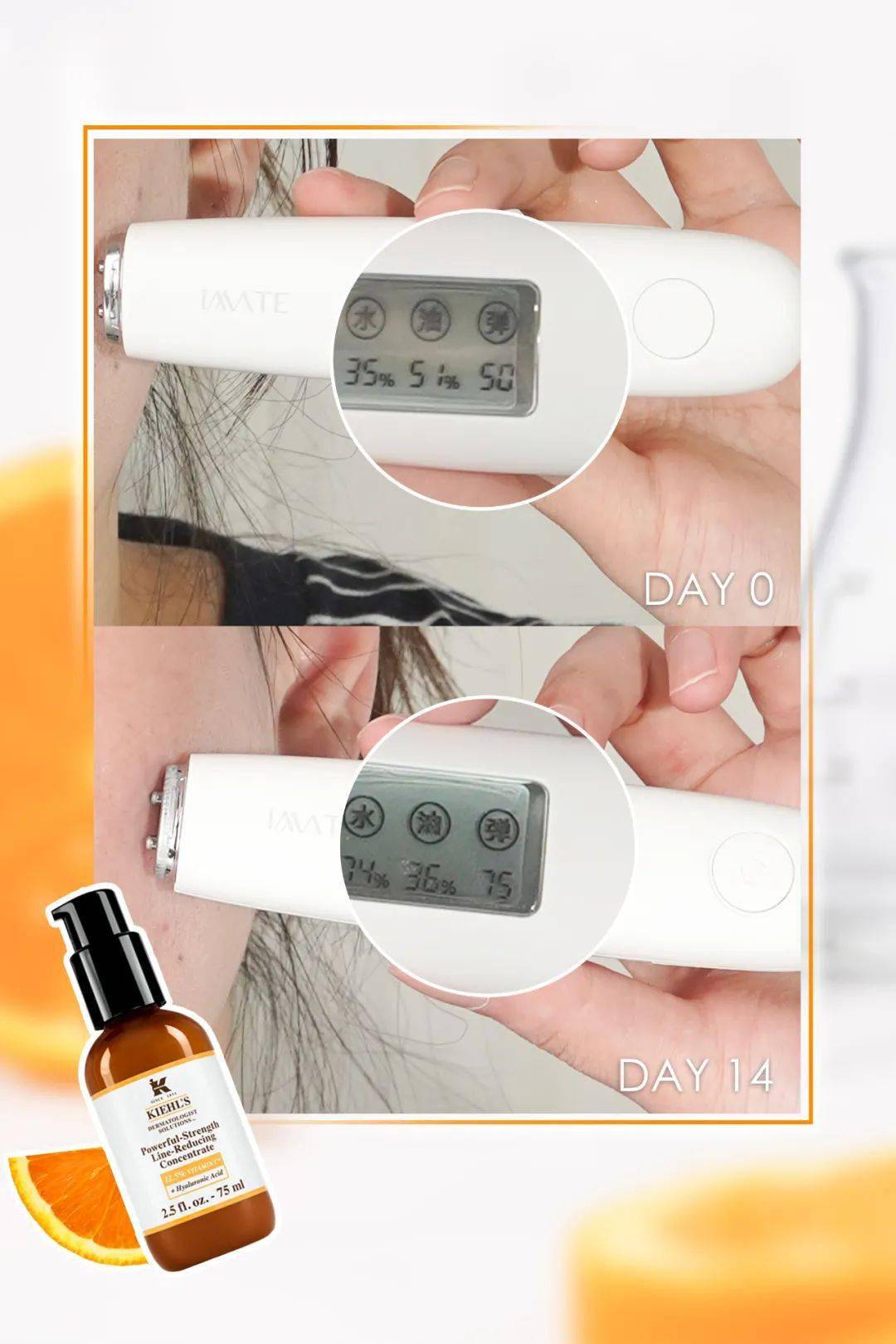 肌肤|连黄子韬都安利的热玛吉，真的有用吗？
