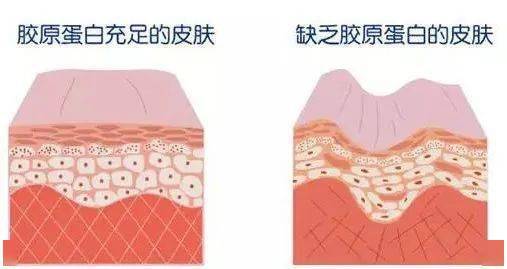肌肤|连黄子韬都安利的热玛吉，真的有用吗？