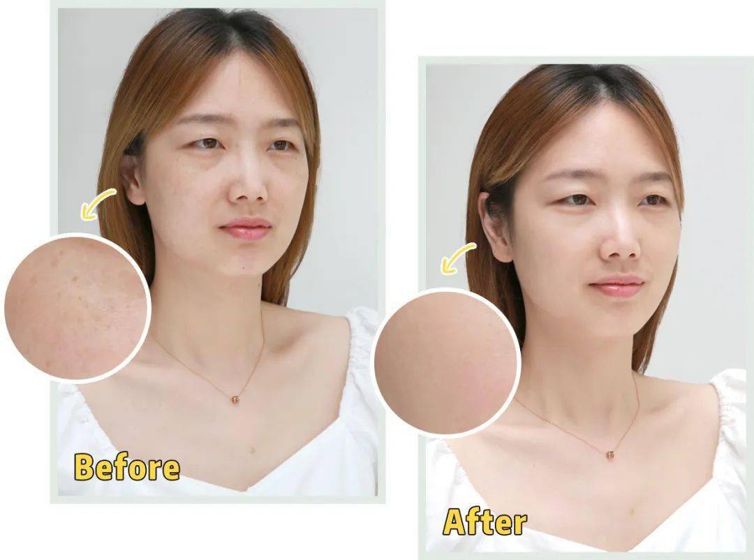 黑色素|广告商特别叮嘱我们，这篇推送的图片不许PS