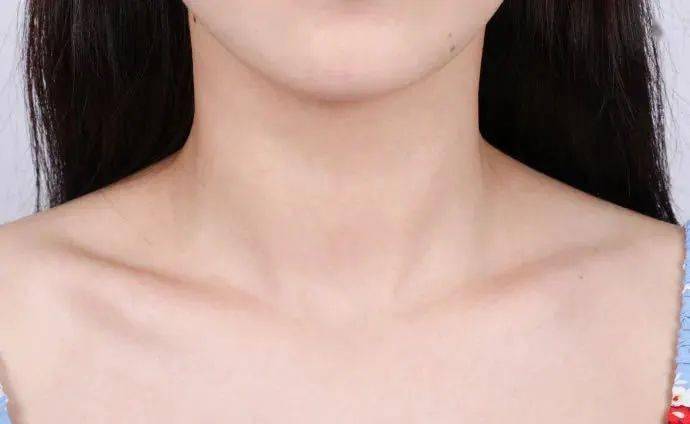 肤色|脖子比脸黑太多？夏日的宝藏救星，没想到竟是它！