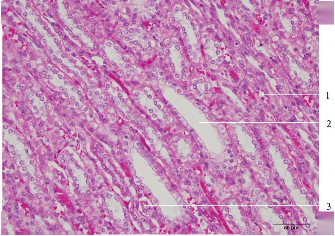 输精管壶腹 4. 精囊腺 5. 尿道球腺 膀胱组织学结构 1.膀胱腔 2.