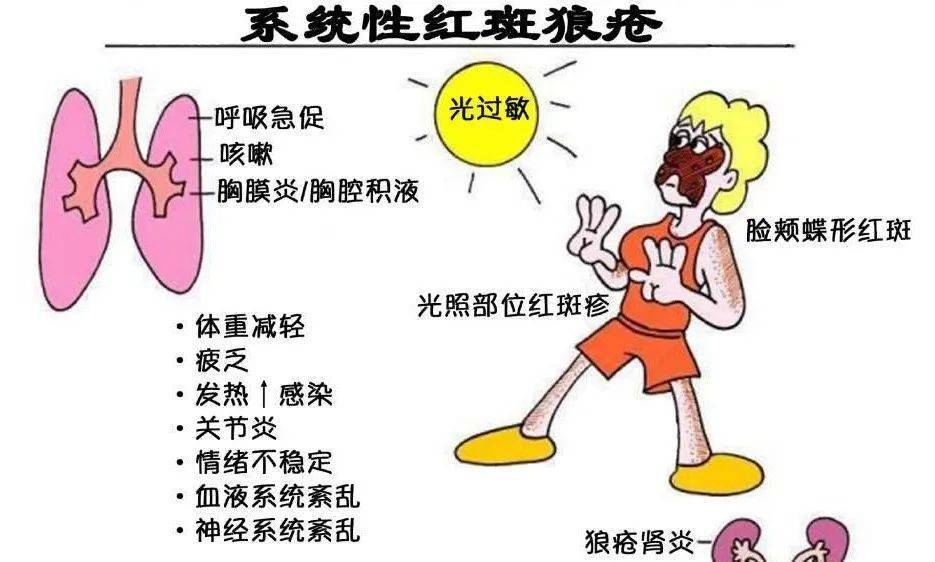 患者|【健康知识】与“狼”共舞，和谐相处