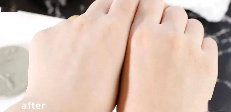 吸铁石|新西兰百年历史“污垢吸铁石”,15分钟告别黑头、粉刺、闭口!