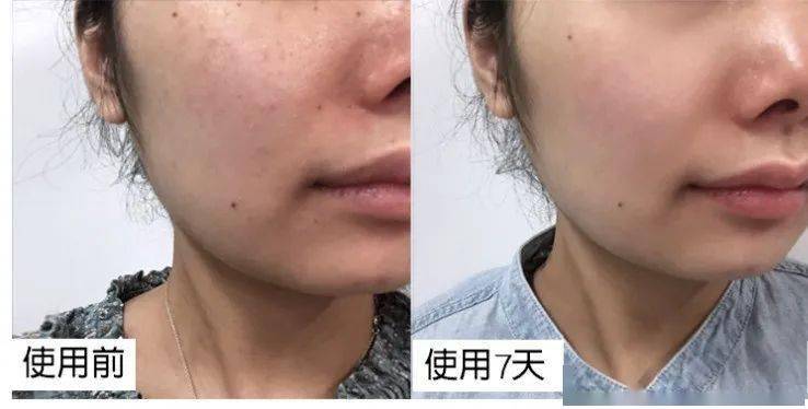 肌肤|50岁钟丽缇干了啥？！迷倒小12岁奶狗，不老神术教教我…