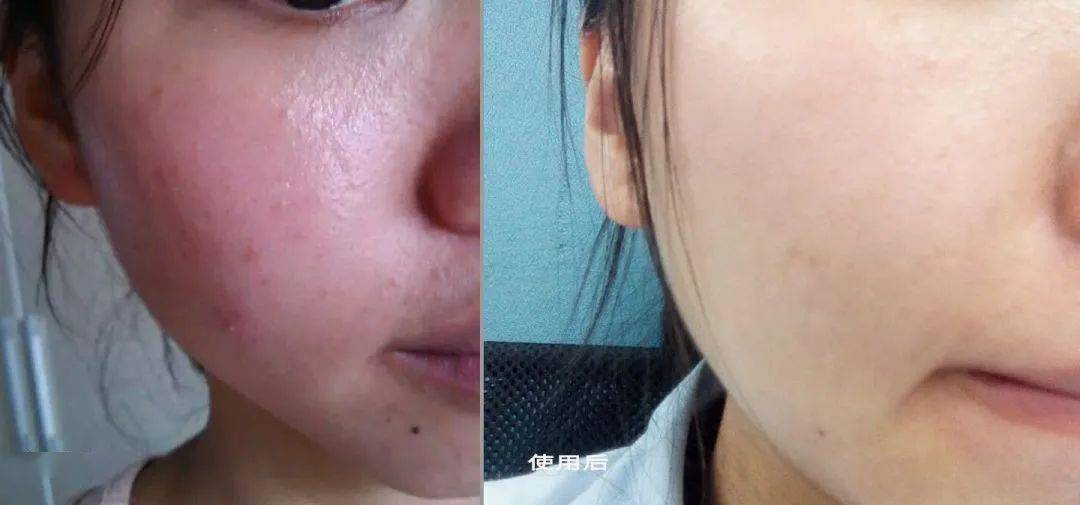 张天|张天爱比杨幂会“撩”?让小奶狗痴迷的她,到底有啥不一样?