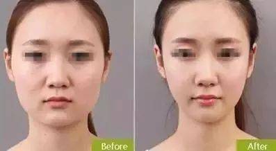 仙女|如何才能拥有天使面孔和魔鬼身材？