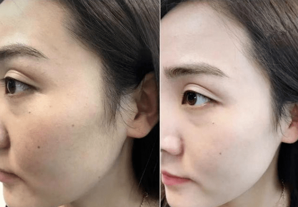 肌肤|皮肤油腻的元凶竟是它！补水保湿，99%的人用错了！