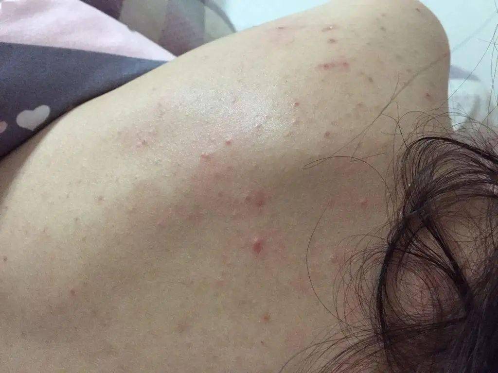 皮肤|想知道如何让肌肤常驻18岁吗？想知道明星三四十岁依然拥有靓丽肌肤吗？点进来我告诉你